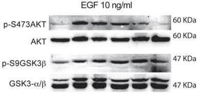 Western Blot: AKT1 [p Ser473] Antibody [NB600-590]